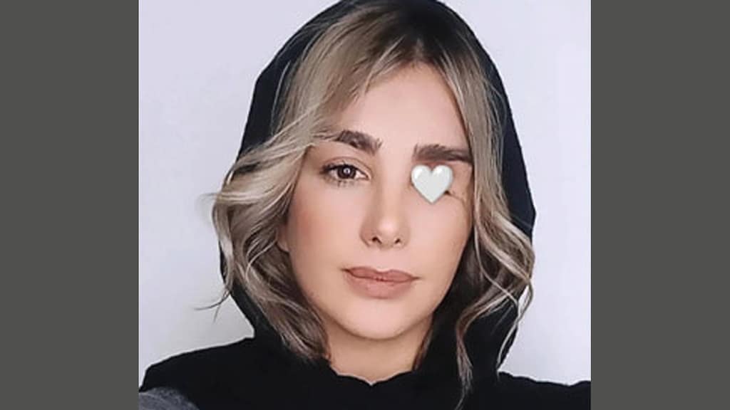 Elaheh verloor oog tijdens protest.