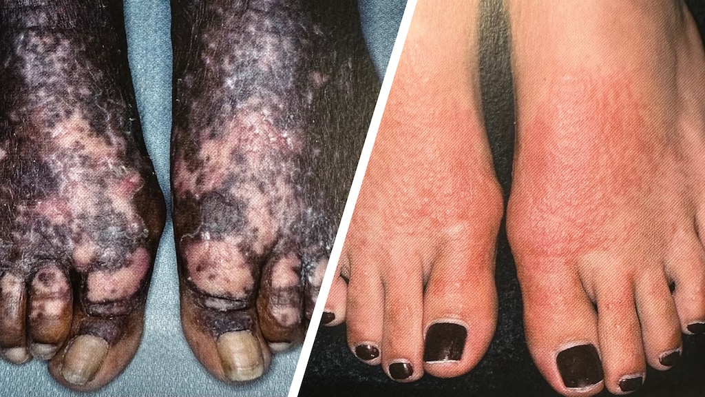 Foto uit Dermatology Bologna