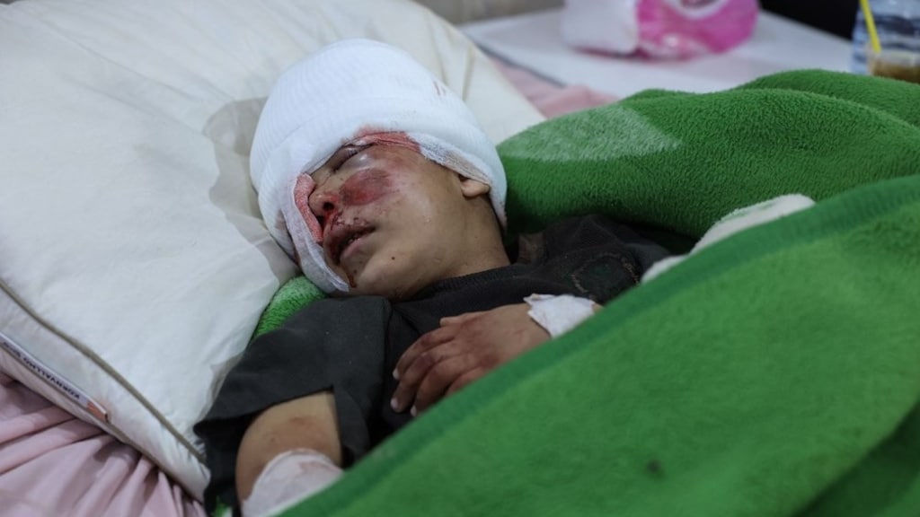 Een zwaargewonde jongen ligt in een ziekenhuis in de Syrische stad Darkush
