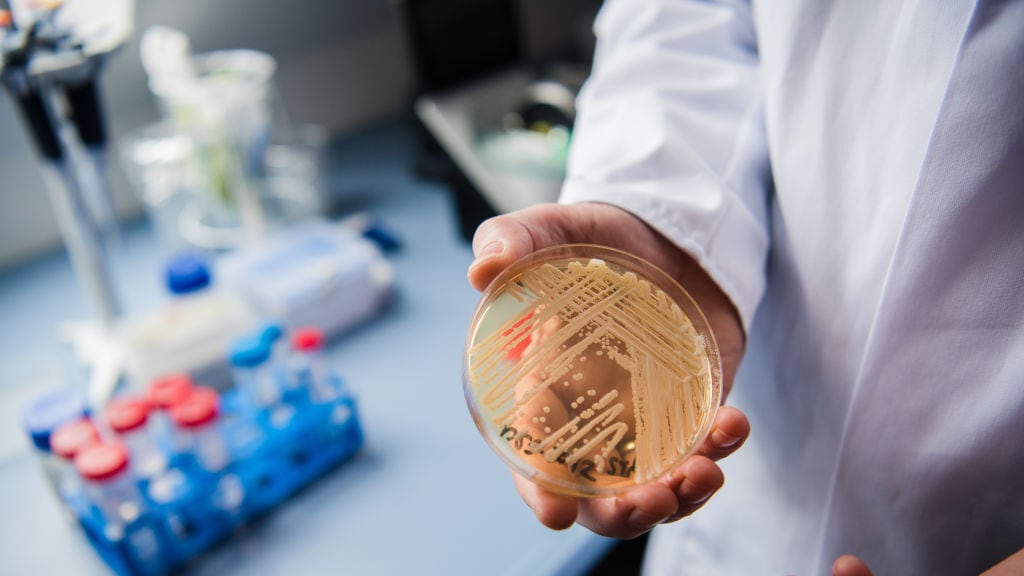 Gevaarlijke schimmelziekte rukt snel op in Verenigde Staten