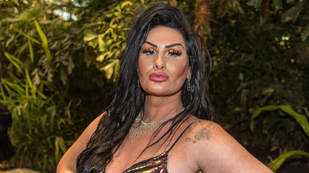 Louisa Janssen opnieuw onder het mes na opnames Echte Meisjes in de Jungle: 'Weer tijd voor wat verbouwingen'