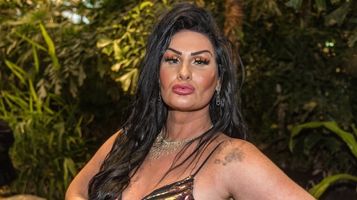 Louisa Janssen opnieuw onder het mes na opnames Echte Meisjes in de Jungle: 'Weer tijd voor wat verbouwingen'