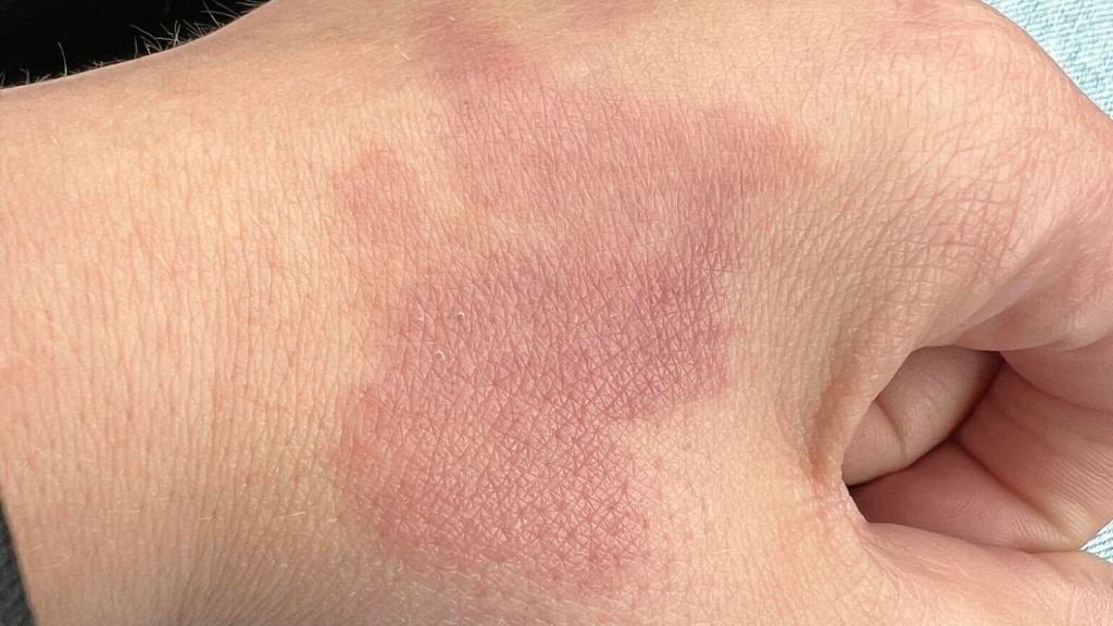 Charity kreeg allerlei soorten klachten.