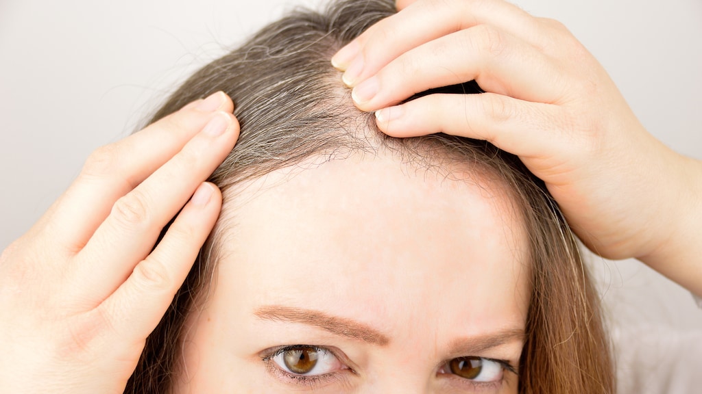 Peggy: 'Ik trek mijn grijze haren uit. Is dit verstandig?'