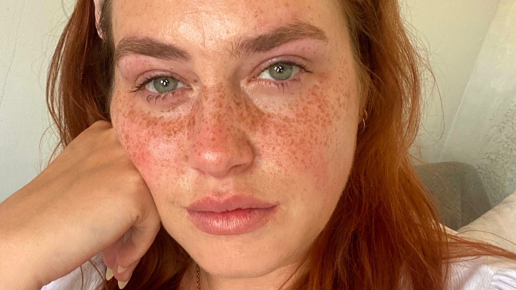 Andrea huilde veel tijdens haar herstelperiode.