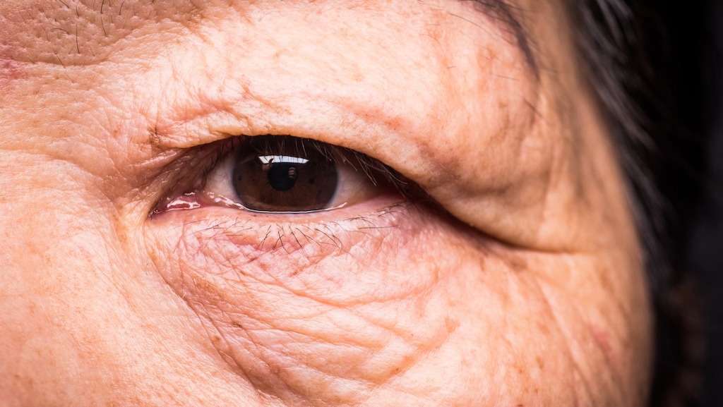 Alzheimer aflezen aan traanvocht: 'Dit is echt een doorbraak'