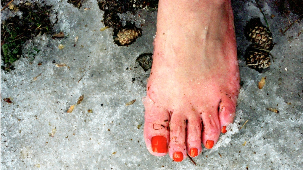 Nadja heeft last van wintertenen: 'Jeuk is bijna ondraaglijk'