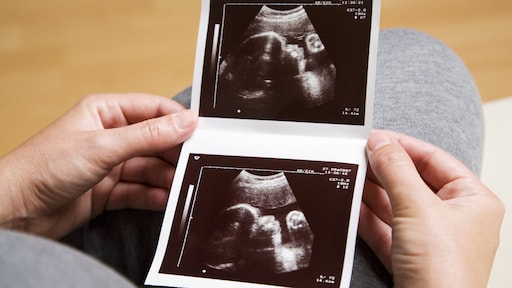 Voor ongeboren kindjes gevaarlijk herpesvirus op te sporen bij zwangeren