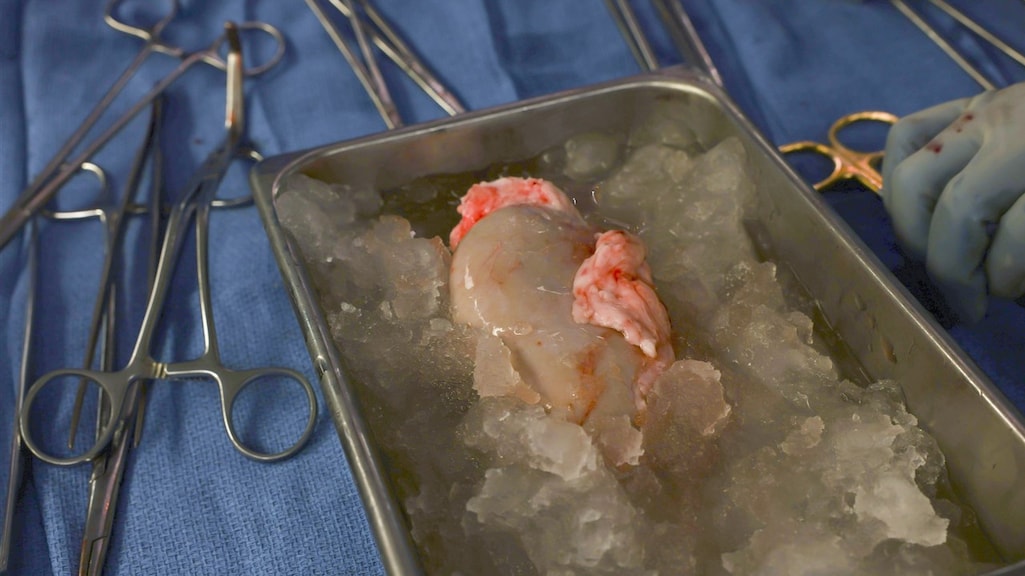 De varkensnier vlak voor het in het lichaam werd geplaatst.