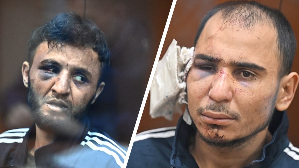 De verdachten zien er zwaar gehavend uit.