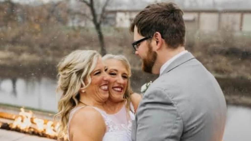 Helft van beroemde Siamese tweeling stapt in huwelijksbootje