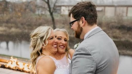 Helft van beroemde Siamese tweeling stapt in huwelijksbootje