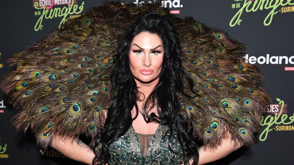 Volgers Louisa Janssen schrikken van resultaat 'vampire facelift'