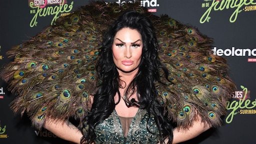 Volgers Louisa Janssen schrikken van resultaat 'vampire facelift'