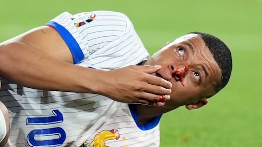 Mist Mbappé wedstrijd tegen Oranje? 'Zo'n masker beschermt niet 100 procent'