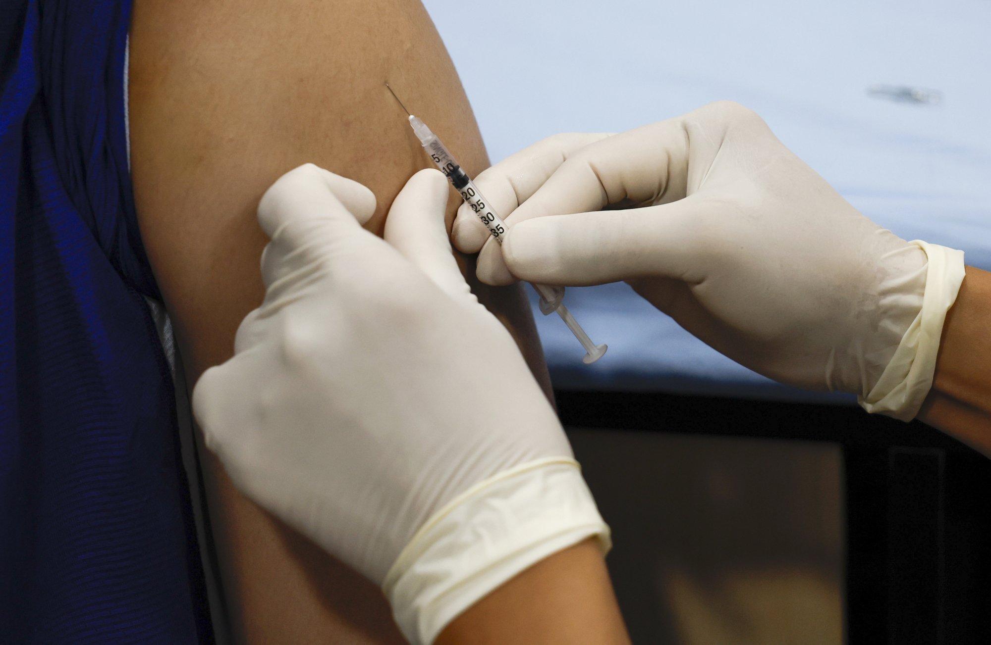 ドイツ、アフリカ諸国に MPOX ワクチンを寄付 | RTL ニュース