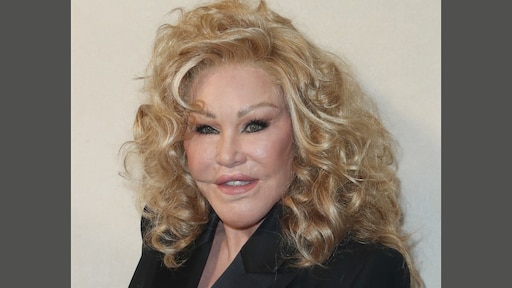 Jocelyn Wildenstein overleden, bekend door cosmetische chirurgie
