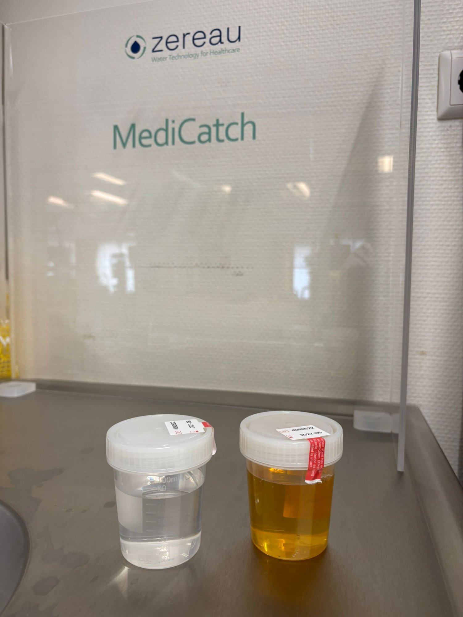 Rechts urine voor filtering, links urine nadat het door het speciale medicijnenfilter is gegaan.