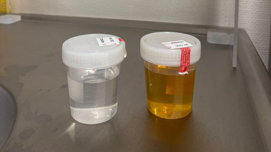 Rechts urine voor filtering, links urine nadat het door het speciale medicijnenfilter is gegaan.
