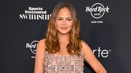 Chrissy Teigen heeft haarlijn laten verlagen: 'Werd dun daarboven'