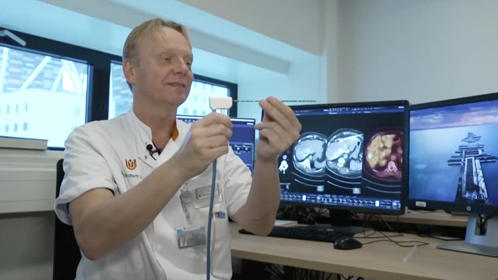 Tumor wegbranden in plaats van snijden blijkt effectieve methode: 'En de hersteltijd is korter'