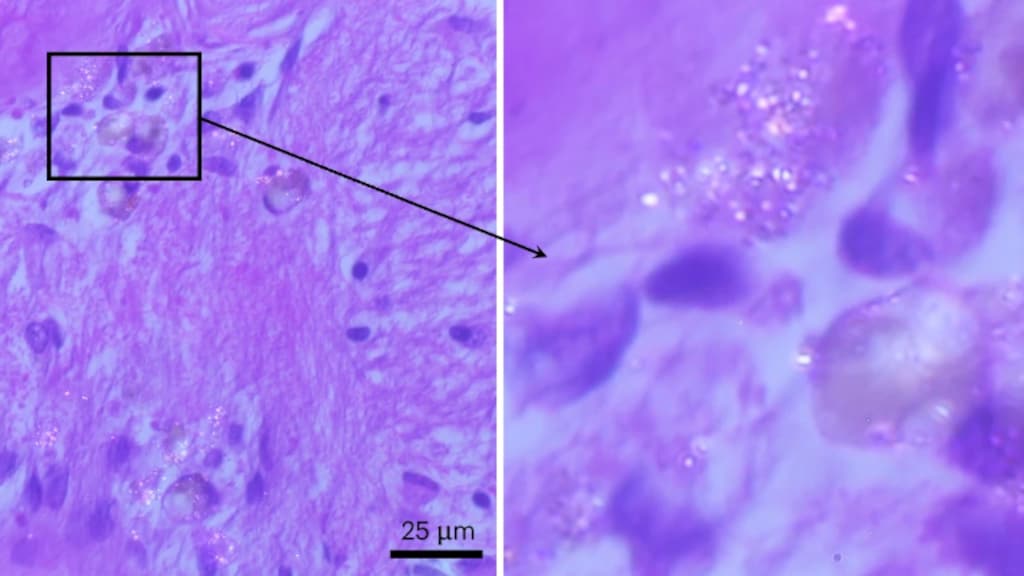 Microplastic hoopt zich op in onze hersenen, eraan ontkomen is 'best lastig'