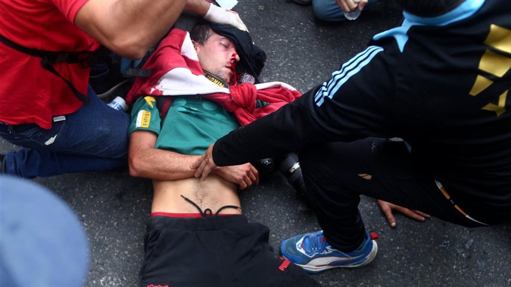 Een fotograaf loopt hersenschade op nadat hij op zijn hoofd is geraakt door een voorwerp.