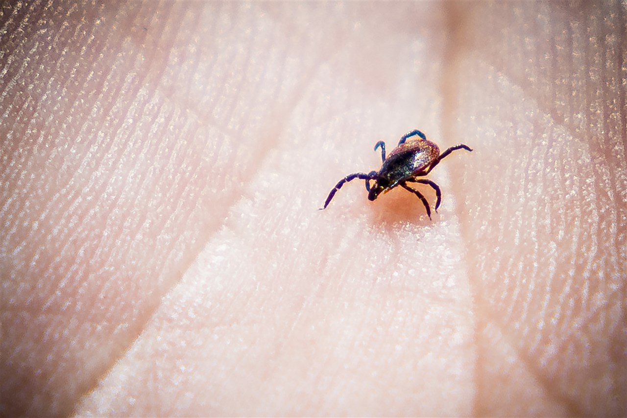Mensen halen teken sneller uit de huid na beet