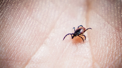 Mensen halen teken sneller uit de huid na beet