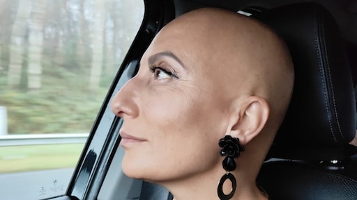 Alopecia maakte Jacqueline (43) in vier dagen kaal: 'Nu zonder haar, maar niet zonder kracht'