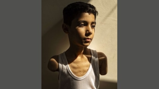 Foto van Palestijns jongetje zonder armen wint World Press Photo