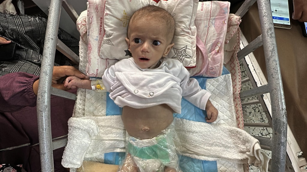 Graatmager door voedselblokkade Gaza: 'Ik zie mijn dochtertje wegkwijnen'