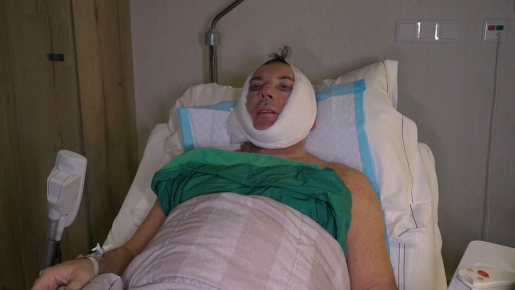 Gerard Joling schrikt van gezicht na ingreep in Only Joling: 'Misselijk als ik mezelf zie'