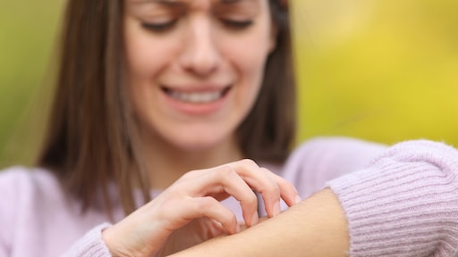 Muggenbulten, hooikoorts: huisartsenposten onder druk door telefoontjes over kleine kwaaltjes