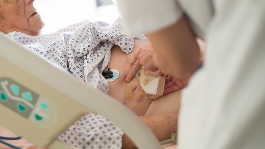 Verdubbeling leverkanker door overgewicht en alcoholgebruik