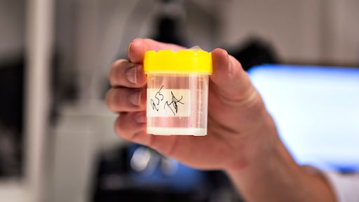 Sperma van Deense donor met mogelijk fatale genetische afwijking niet in Nederland gebruikt