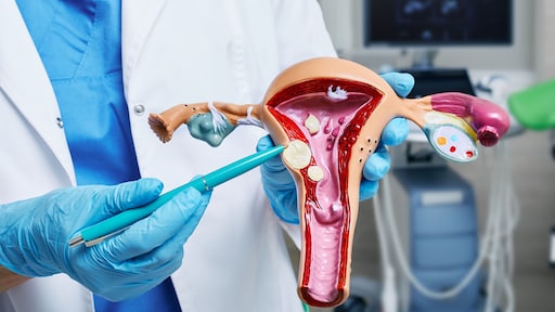 Miljoenen vrouwen hebben een vleesboom, vaak zonder het te weten: 'Ik voelde ineens een bobbel'