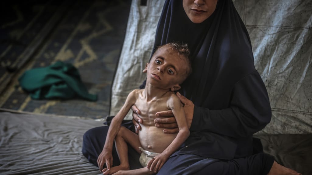 Zorgen en woede om hongersnood in Gaza, terwijl hulp traag op gang komt: 'Het is een keuze'