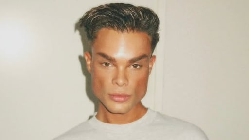 Melle van Rooijen uit Echte Jongens op Safari verwijdert alle fillers uit gezicht: 'Voor nu ben ik tevreden'