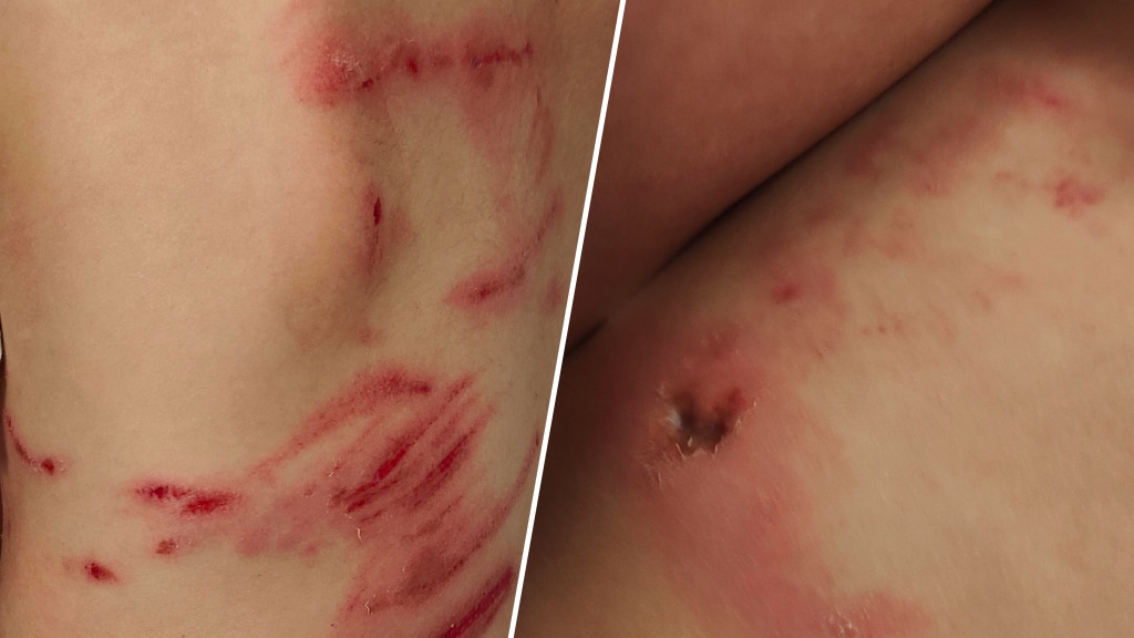 Wolf besprong kind vanaf bankje, vertelt vader: 'Geweld nodig om hem te verjagen'