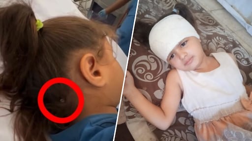 5-jarige Lana uit Gaza overleeft op miraculeuze wijze kogel in schedel: 'Kinderen zijn doelwit'
