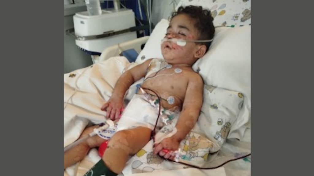 Sanad is inmiddels ruim 2 jaar oud, maar nog altijd niet hersteld van het bombardement