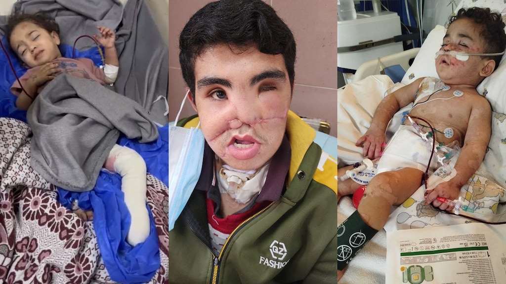 Deze ernstig gewonde kinderen mogen Gaza uit, Nederland wil ze hier niet behandelen