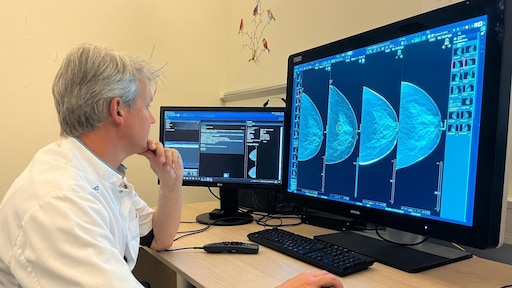 AI kan radioloog vervangen bij borstkankerscreening, blijkt uit Nederlands onderzoek
