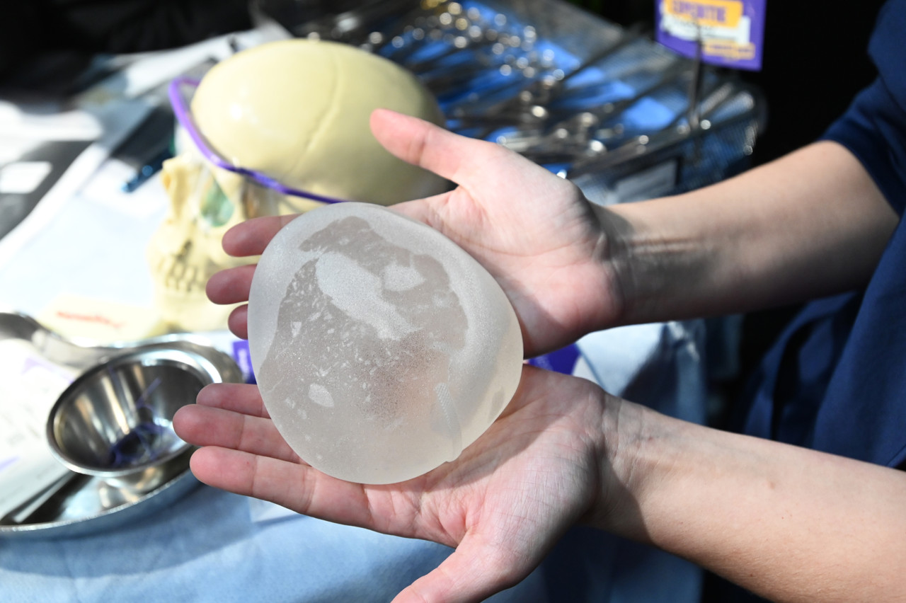 In 10 jaar tijd lieten ruim 14.000 vrouwen hun borstimplantaten weghalen