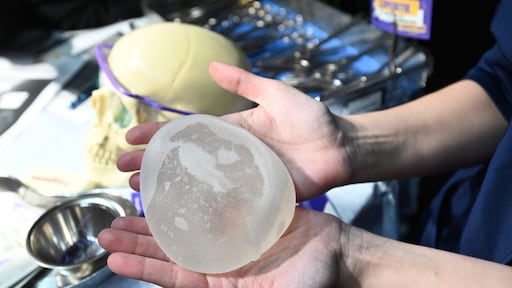 In 10 jaar tijd lieten ruim 14.000 vrouwen hun borstimplantaten weghalen