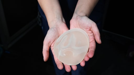 Massaclaim namens 60.000 vrouwen: schadevergoeding om borstimplantaten