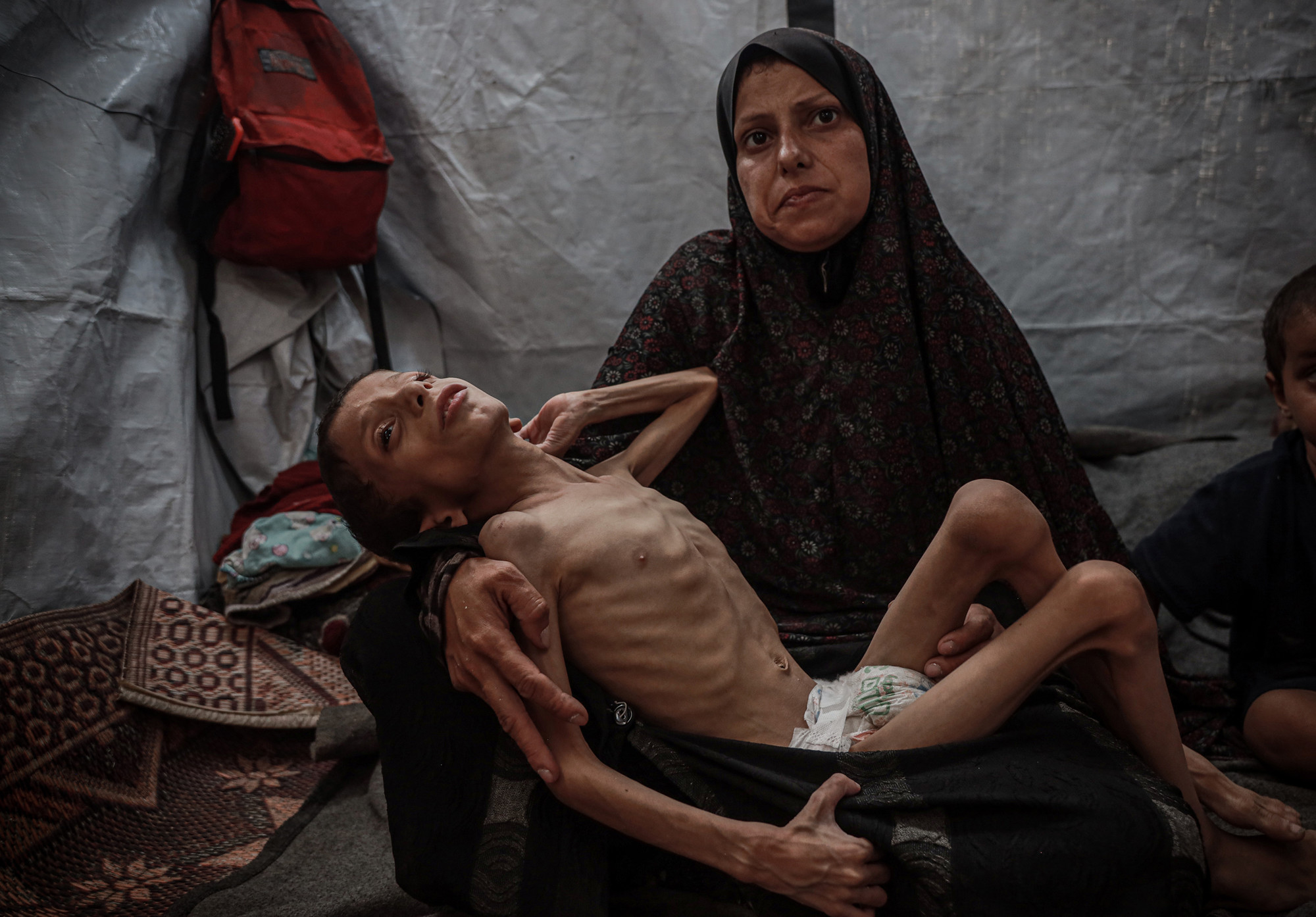 De 10-jarige Navz Muhammed Nasr, zwaar ondervoed, in een opvangtent met zijn familie in Deir al Balah.