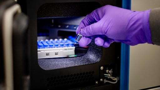 Met nieuwe techniek kunnen onderzoekers glijmiddel aantonen na zedenmisdrijf