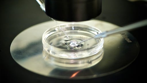 Voor het eerst embryo uit huidcel gecreëerd: 'Kind van twee vaders ooit mogelijk'